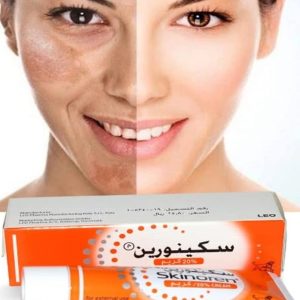 کرم ضد آکنه 30 گرمی