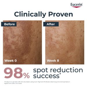 کرم سرم دوگانه صورت حتی پیگمنت پرفکتور، کاهش لک های رنگدانه مناسب برای انواع پوست 30 میلی لیتر 30 میلی لیتر